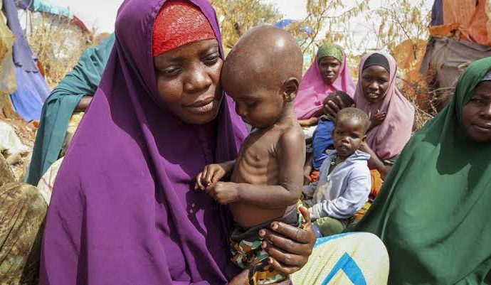 Somalia Child Hunger Crisis Deepens as 205 Health Centres Close